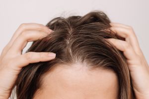 Vet haar? 8 tips om het natuurlijk aan te pakken