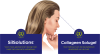 Collageen Solugel® sachets