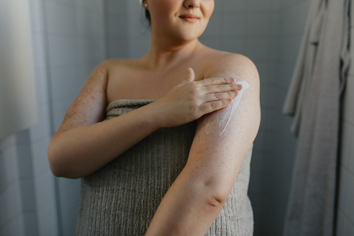Vrouw smeert zalf op arm